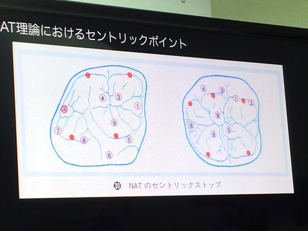 第10回　技工勉強会