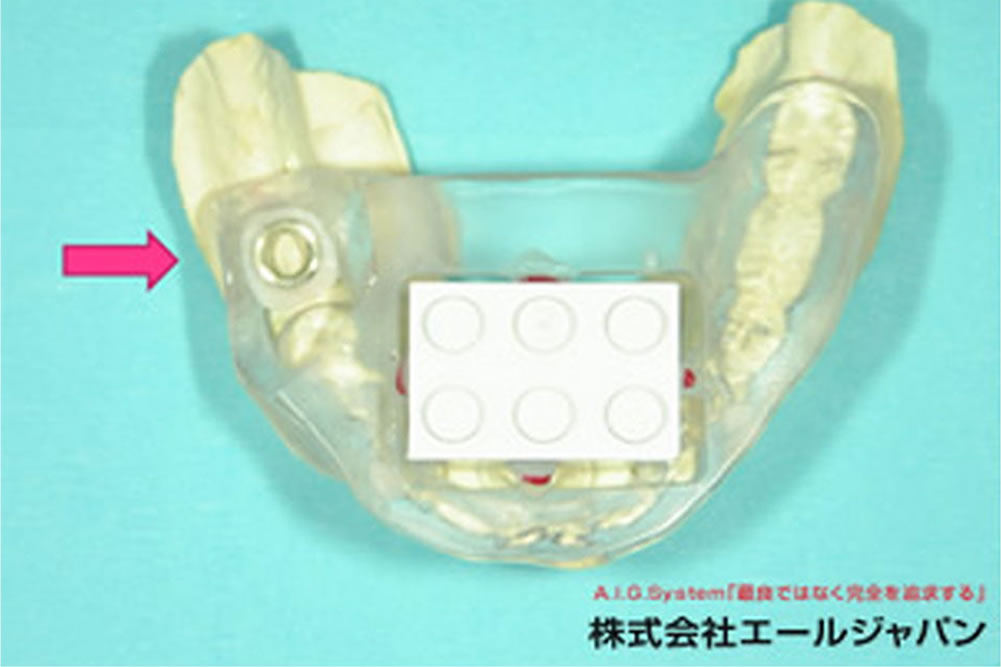 エールガイド
