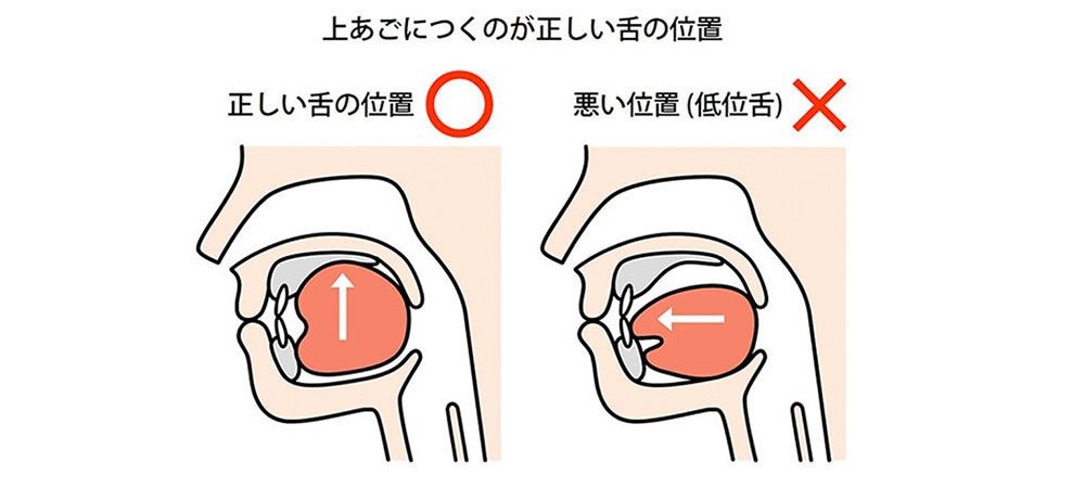 舌の位置